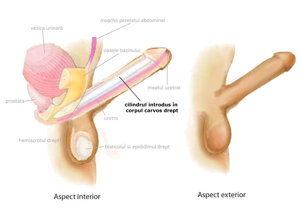 penis in erectie indreptat spre jos | Forumul Medical ROmedic